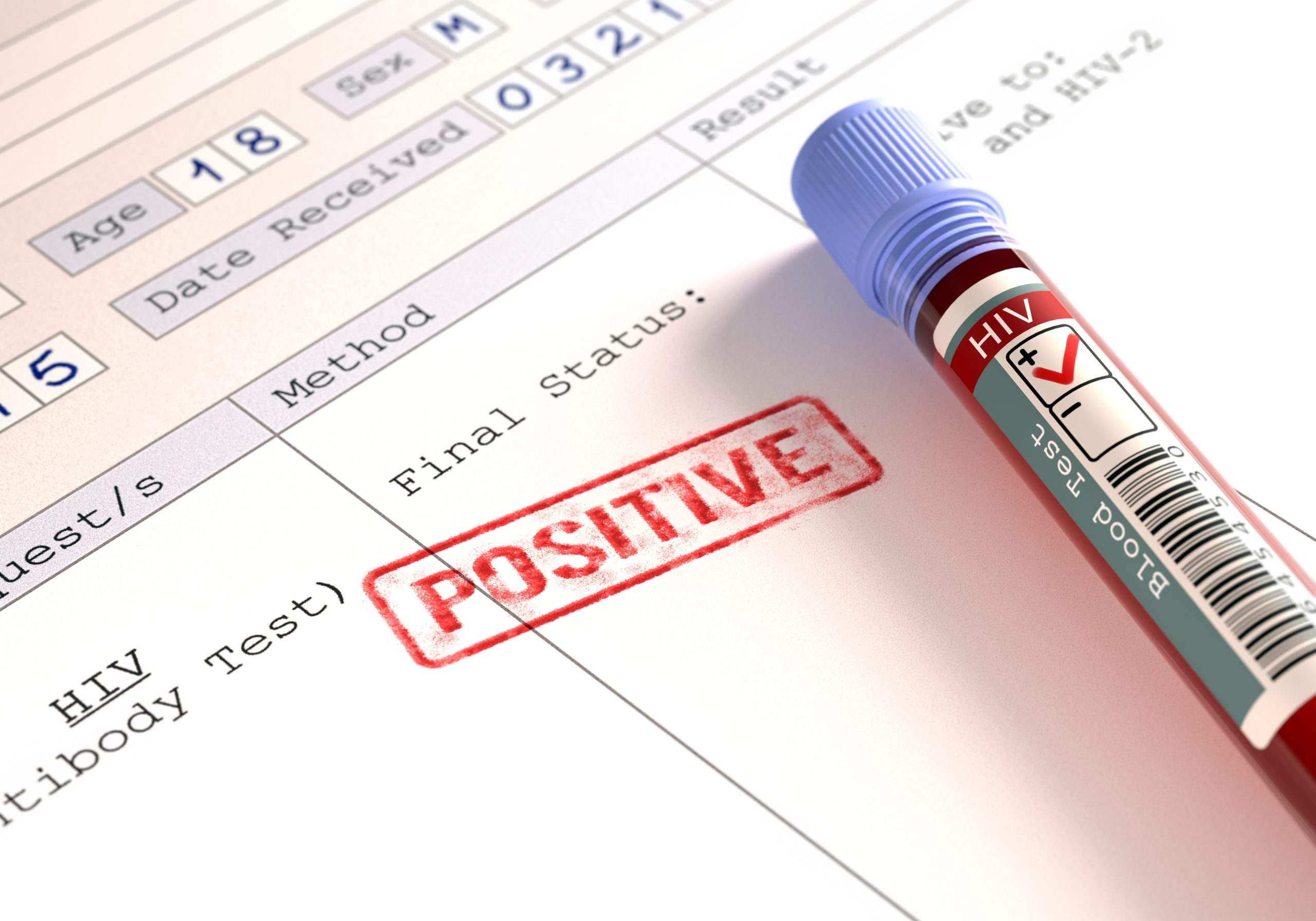 la dernière grande avancée contre le HIV