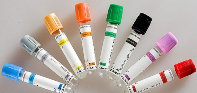 Savez-vous quelle est l'utilité clinique des tubes de sang ?