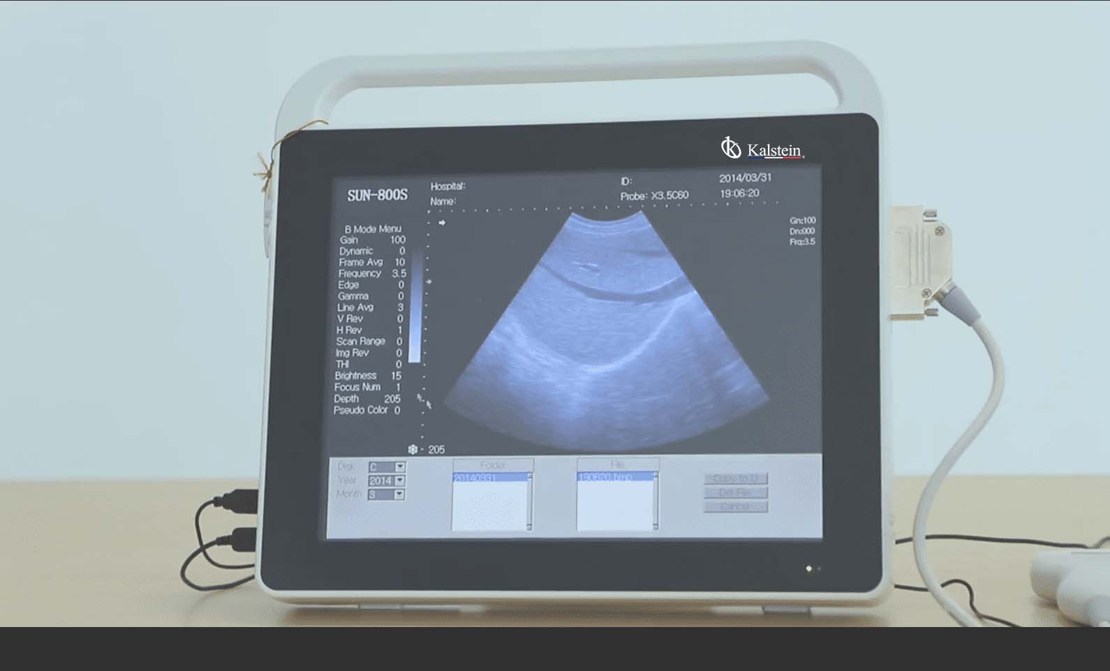 Scanner à ultrasons : caractéristiques et types