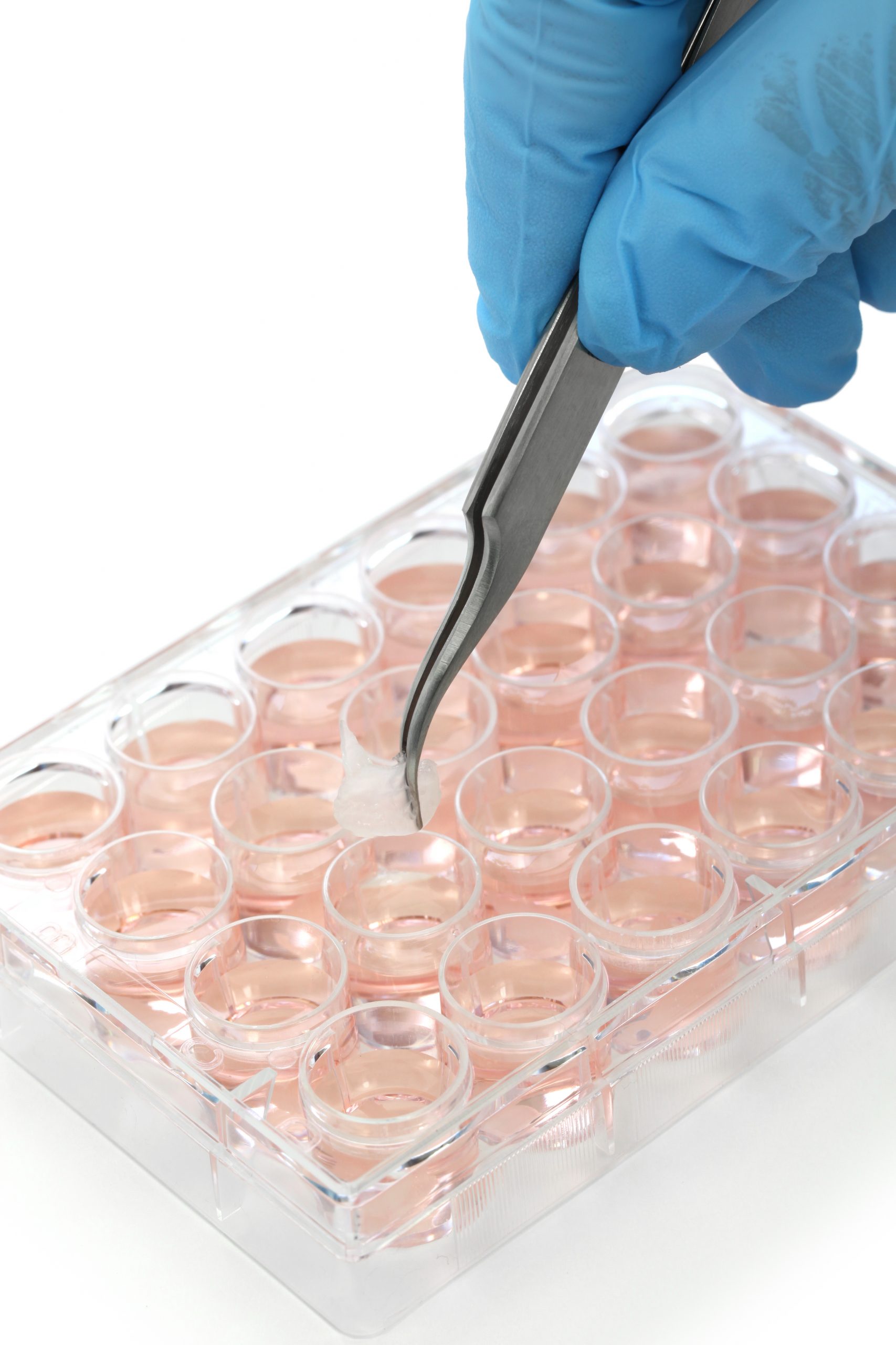 Elisa washing machine to detect Human Lymphotropic Virus infection