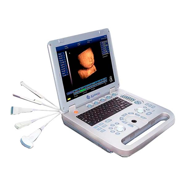 Utilisation du scanner à ultrasons dans le diagnostic des maladies du rein