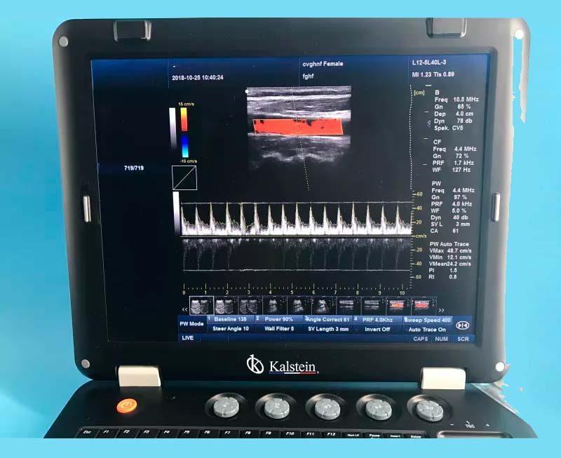 Machine médicale d'ultrason de l'article 128 THI 3D à vendre avec la sonde convexe YR05148 – 1