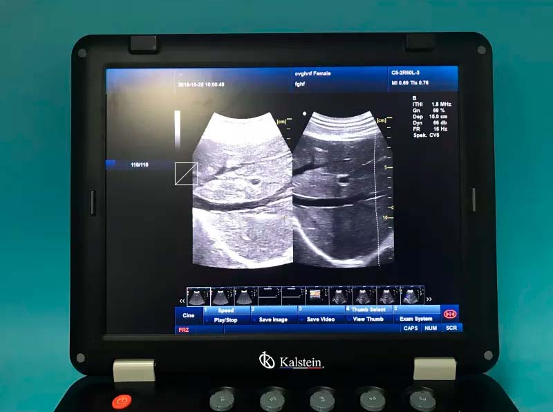 Machine médicale d'ultrason de l'article 128 THI 3D à vendre avec la sonde convexe YR05148 – 2