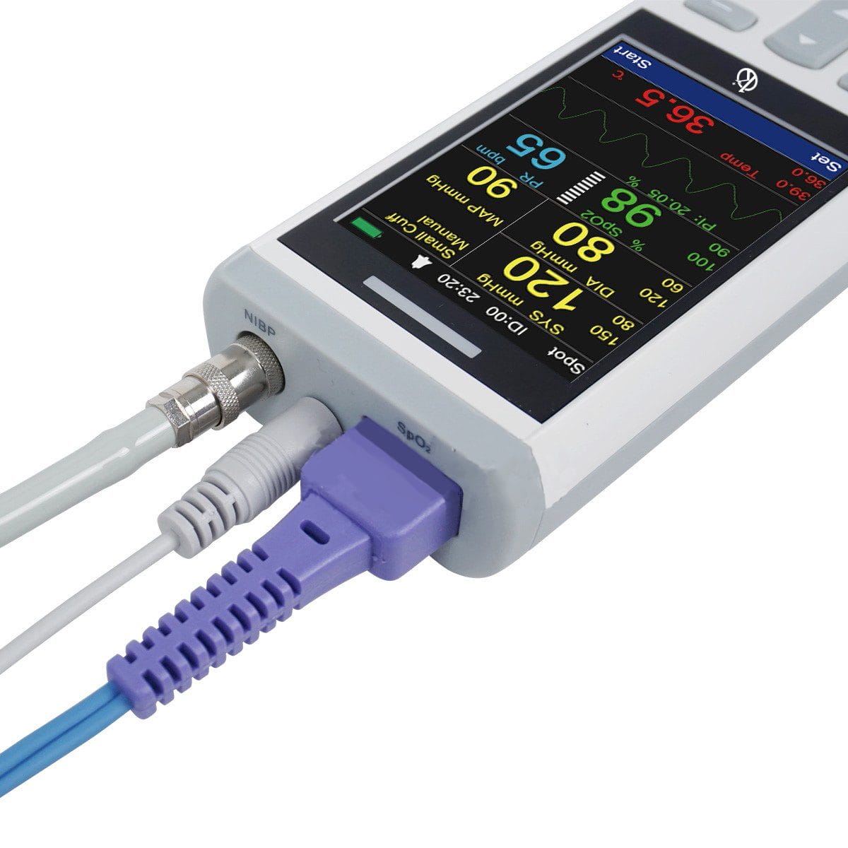 Kalstein Veterinary Monitors: Enhancing the Quality of Animal Care
