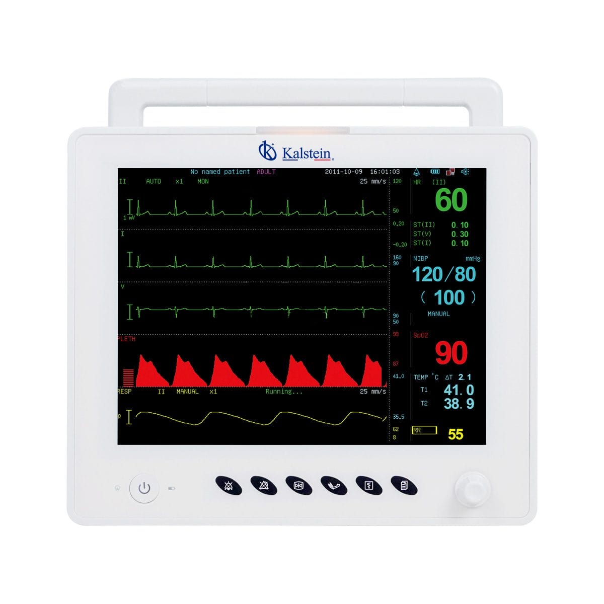 Boosting Veterinary Care with Kalstein Veterinary Monitors: A Fundamental Breakthrough in Animal Medicine