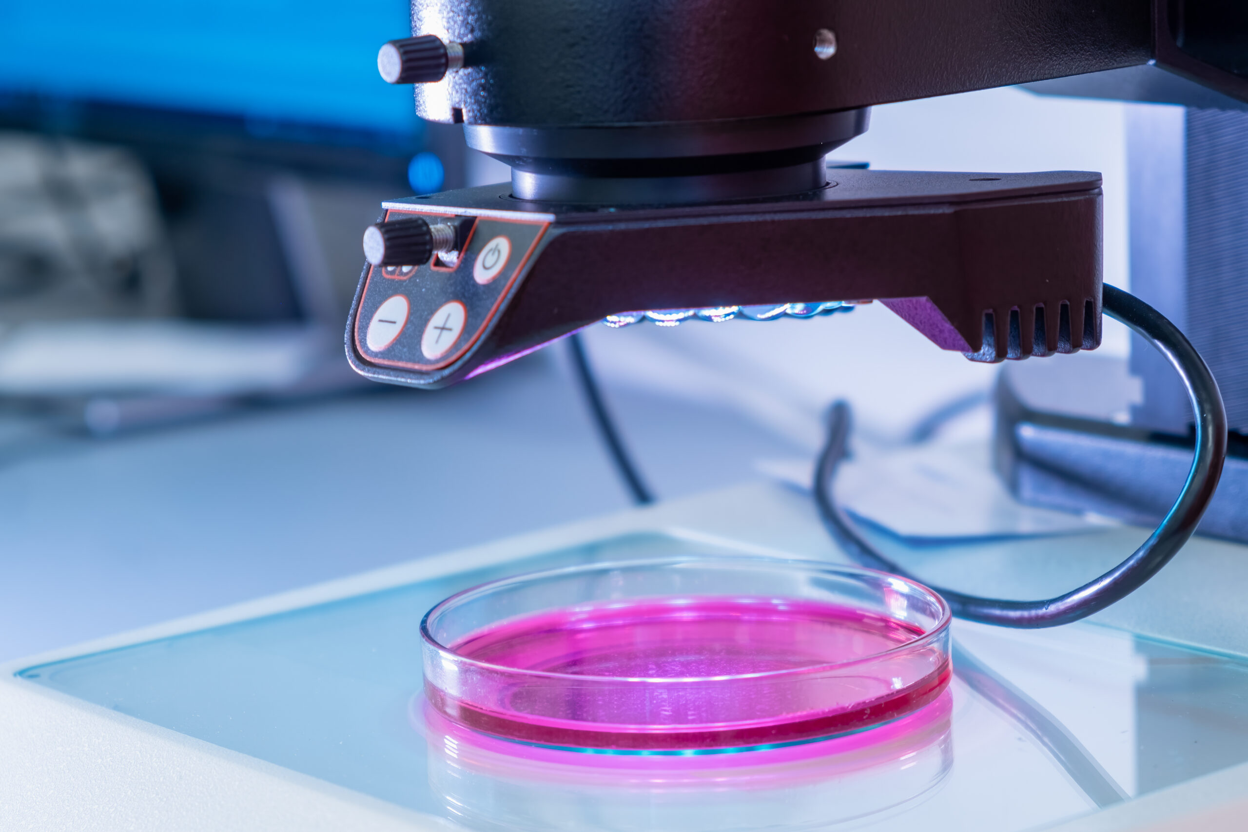 How is HIV detected using the microscope?