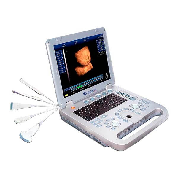 Découvrez les Scanners à Ultrasons: L'Innovation Médicale de Kalstein