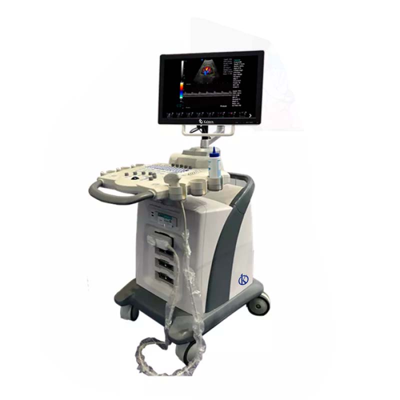 Explorer les Scanner A Ultrasons : Un Outil Indispensable Pour la Médecine Moderne